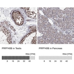 PRPF40B Antibody, Novus Biologicals 0.1mL; Unlabeled:Antibodies, Polyclonal